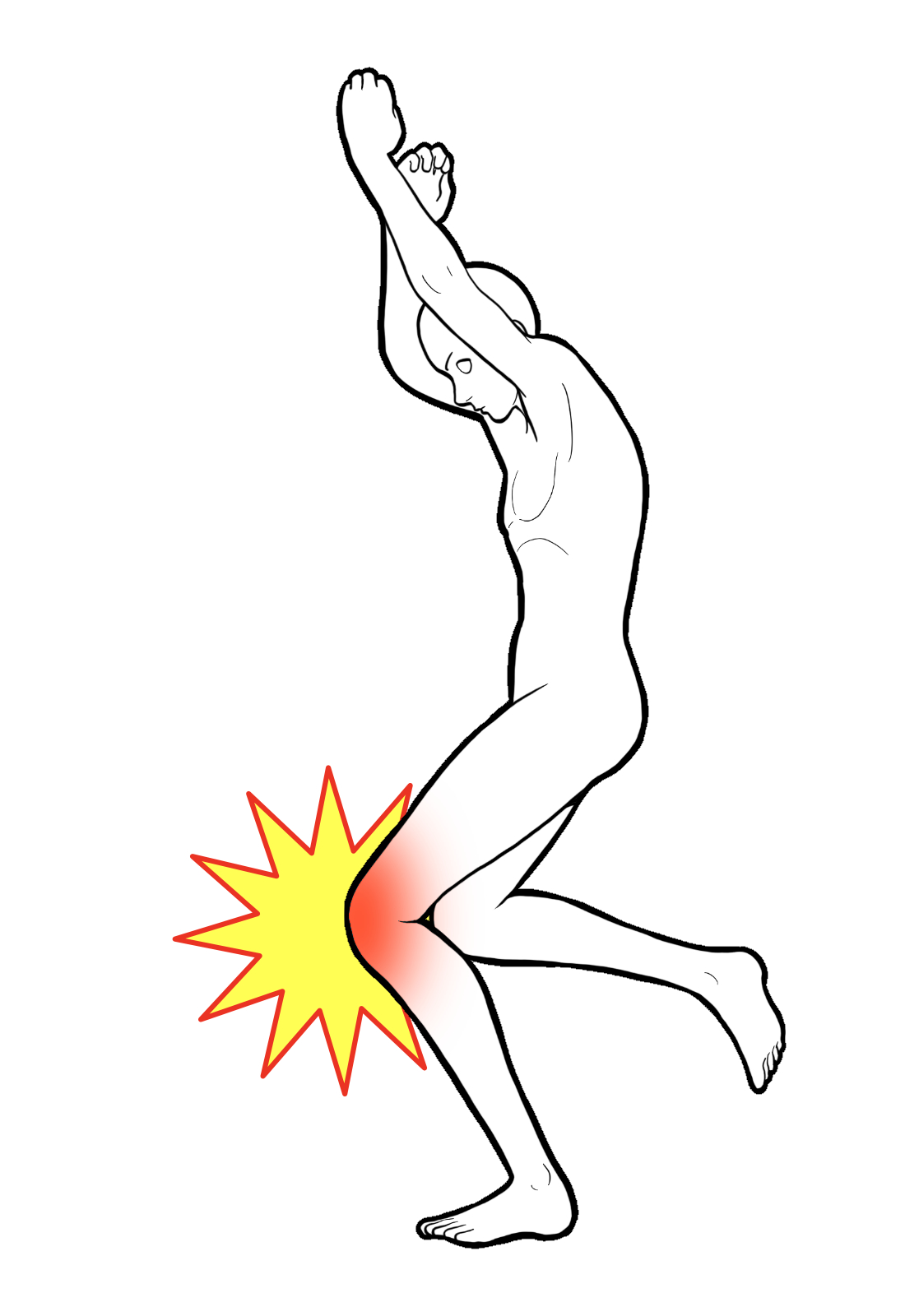 ジャンパー膝で膝の前に痛みがある様子のイラスト