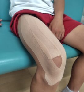症状に合わせて行うテーピング処置