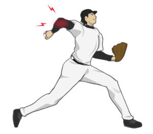 野球肘で肘の痛みを感じる野球少年