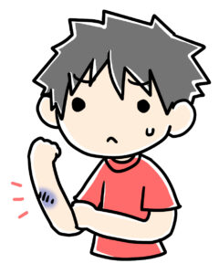 腕を打撲して痛がっている子どものイラスト